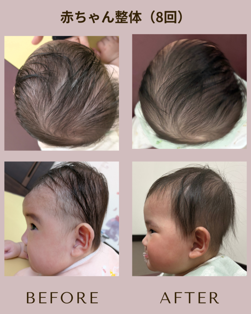 小野市　ママと赤ちゃんの整体院【ソルシエ】　赤ちゃん整体　向き癖　頭の形　骨盤矯正　骨盤ケア　ママリュクス認定店