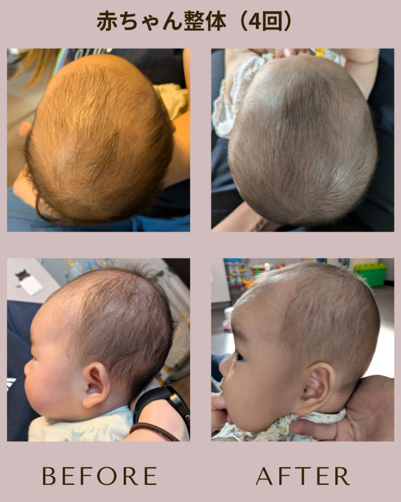 小野市　ママと赤ちゃんの整体院【ソルシエ】　赤ちゃん整体　向き癖　頭の形　骨盤矯正　骨盤ケア　ママリュクス認定店