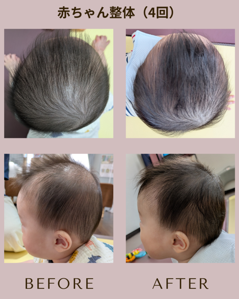 小野市　ママと赤ちゃんの整体院【ソルシエ】　赤ちゃん整体　向き癖　頭の形　骨盤矯正　骨盤ケア　ママリュクス認定店